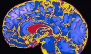 MRI-scan-of-human-brain-008